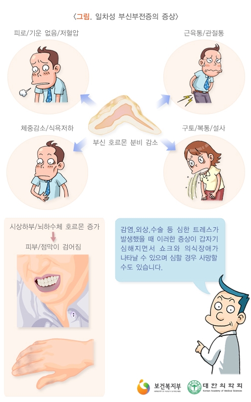 부신기능저하증 증상