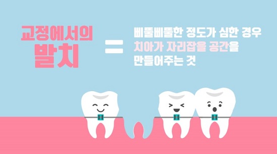 가장 많이 궁금해 하는 치아교정 궁금증 5가지