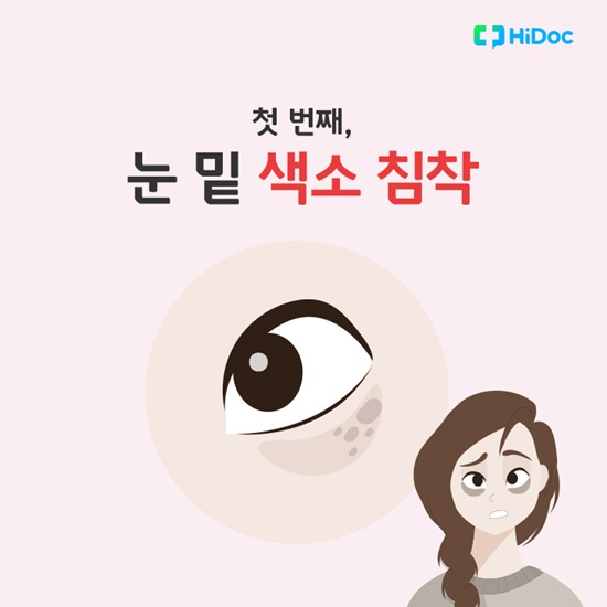 멜라닌 세포가 증가해서 생기는 색소 침착이 다크서클의 원인