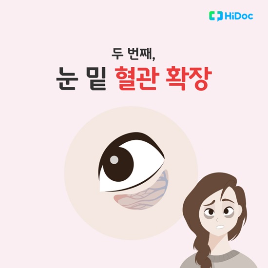 눈 주위 피부는 두께가 얇고 투명해서 혈관이 비치기 쉽다