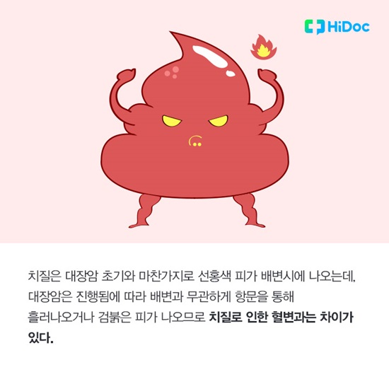  치질은 대장암 초기와 마찬가지로 선홍색 피가 나온다