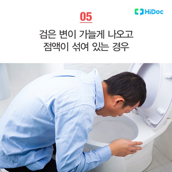 검은 변이 가늘게 나오고 점액이 섞여 있는 경우