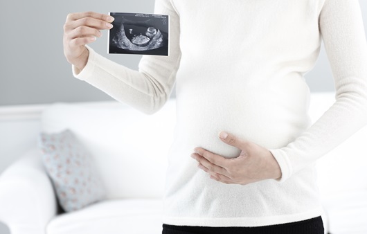 태아 사진을 들고 있는 임신부