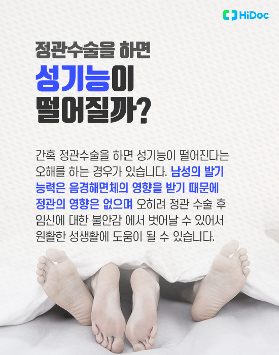 정관수술의 피임 효과, 임신 가능성은 없을까?