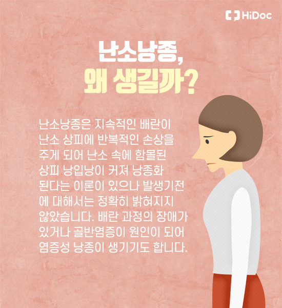 난소암과 난소낭종 바로알기