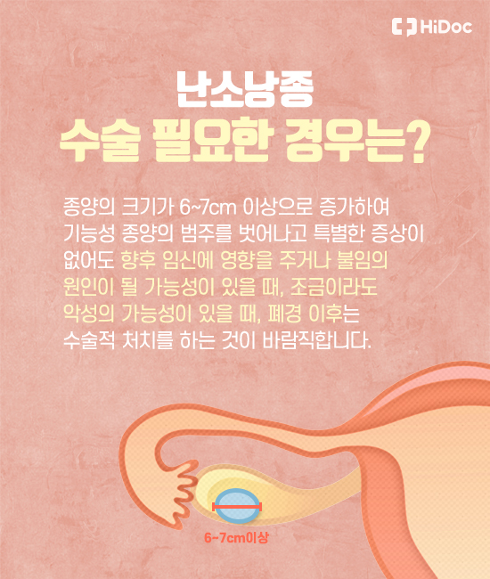 난소암과 난소낭종 바로알기