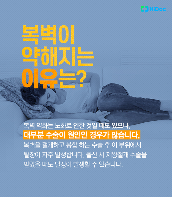 배에 볼록하게 만져지는 혹, 복벽탈장 왜 생길까?