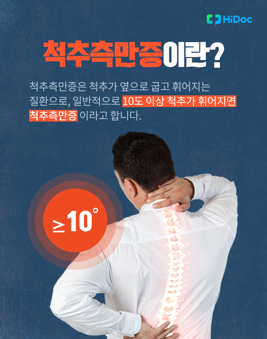 굽고 휘어진 척추, 척추측만증 의심 증상은? 