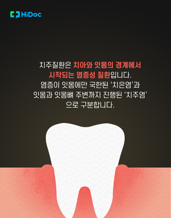 치은염, 치주염 등 ‘치주질환’ 원인과 예방법 