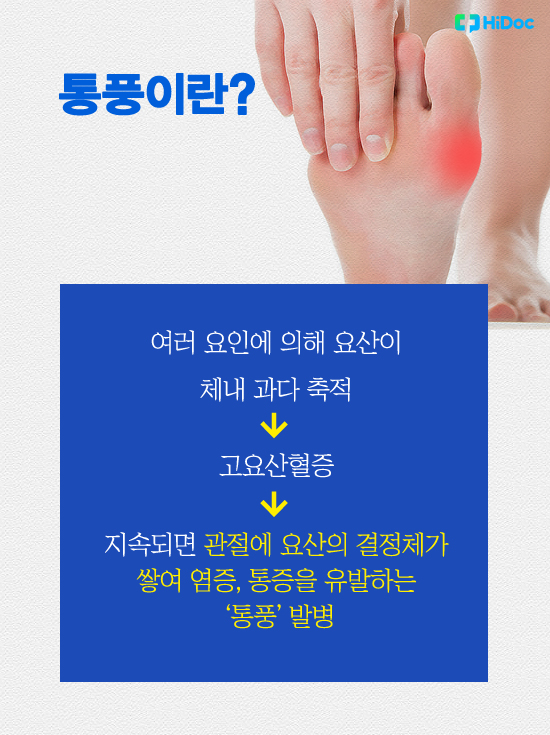 통풍이란?