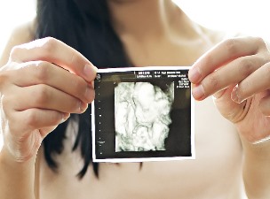 자궁 초음파 사진
