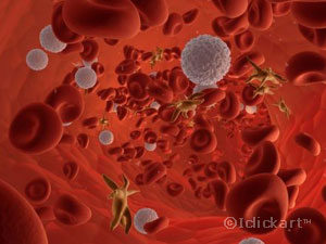 혈액세포와패혈증세포