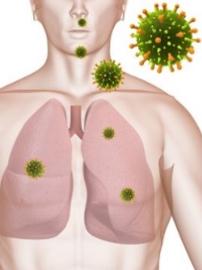 호흡기를 통해 폐에 쌓이는 미세먼지