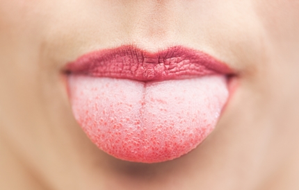 혀를 보면 건강이 보인다! 설진 진단법이란?