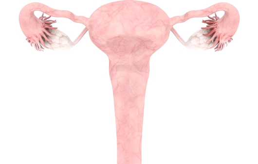 여성암 7위 자궁경부암과 방사선치료