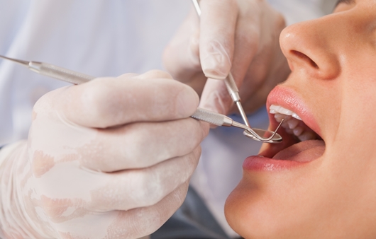 치주질환을 예방하는 보험 적용 치아스케일링