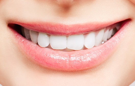 하얗고 빛나는 치아 만드는 치아미백, 엄연한 치과시술