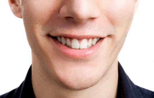 구강건강과 고른 치아를 위한 교정치료 3단계