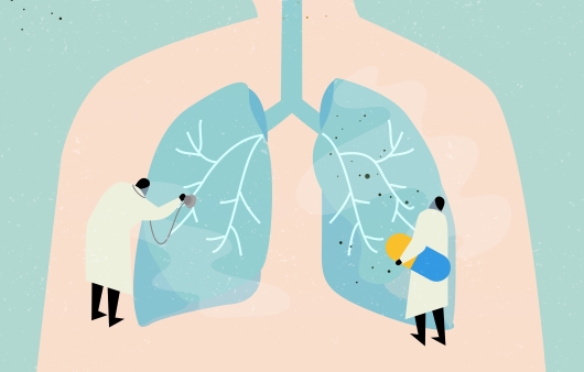 수술 부위 통증·호흡곤란 등 폐암 치료법에 따른 합병증