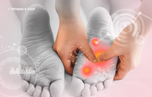 발 디딜 때 심한 통증 ‘족저근막염’의 예방법