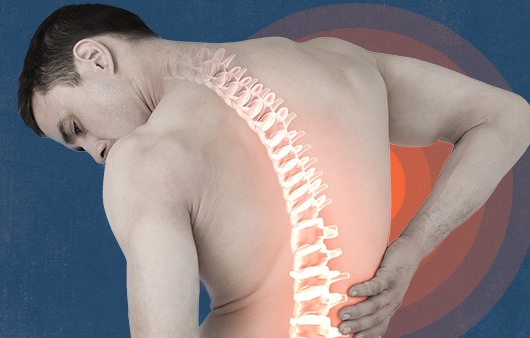 굽고 휘어진 척추, ‘척추측만증’ 의심 증상은?