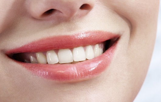 치아의 SHEILD 역할을 해 주는 ‘불소도포’란?