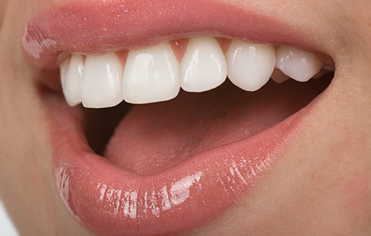 이가 시려요! 치아표면이 깨지는 치경부 마모증이란?