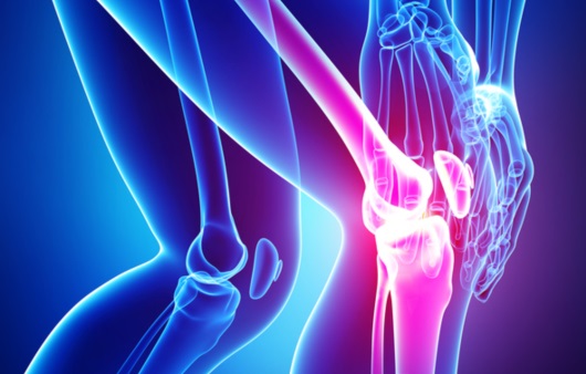 무릎 관절염 있다면 ‘이 질환’을 경계하라?
