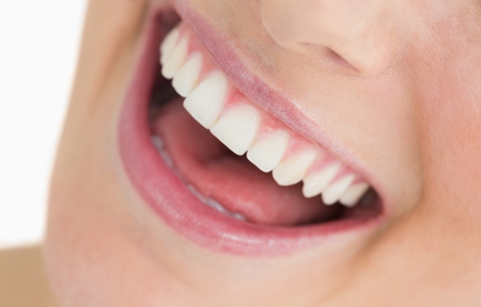 활짝 웃을 수 있는 치아교정, 인비절라인 투명교정