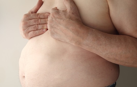 음경확대를 하는 남자들 (16) 반드시 극복해야 하는 복부비만증