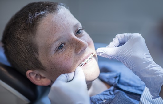 치아교정 치료