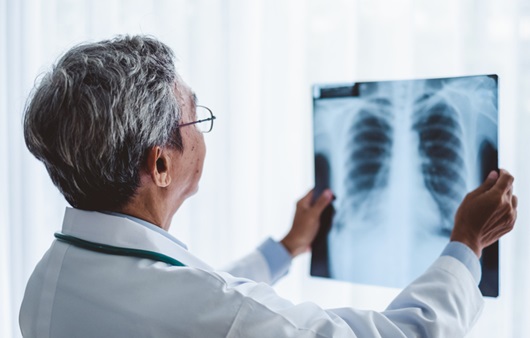폐 x-레이를 보고 있는 의사