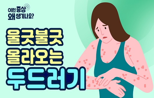 두드러기의 다양한 원인과 증상