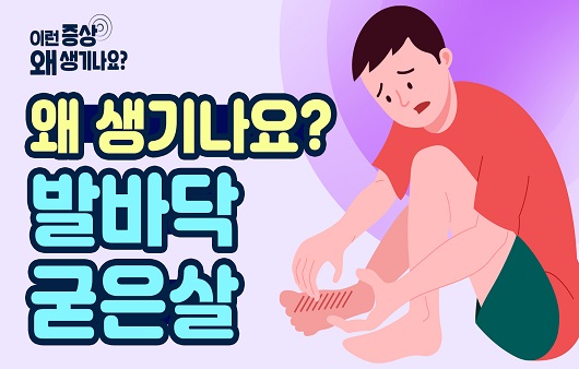 발바닥굳은살원인 알아보기