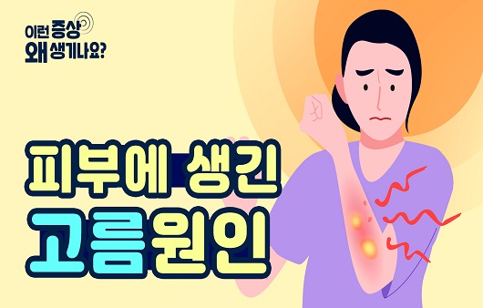 피부 고름은 다양한 원인에 의해 발생한다.