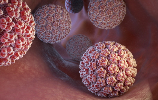 인유두종 바이러스(HPV)에 감염되면 무조건 자궁경부암 생길까? [앎으로 이기는 암2]