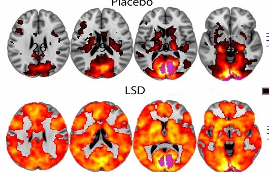 LSD 투약 시 뇌의 변화 ㅣ출처: Google