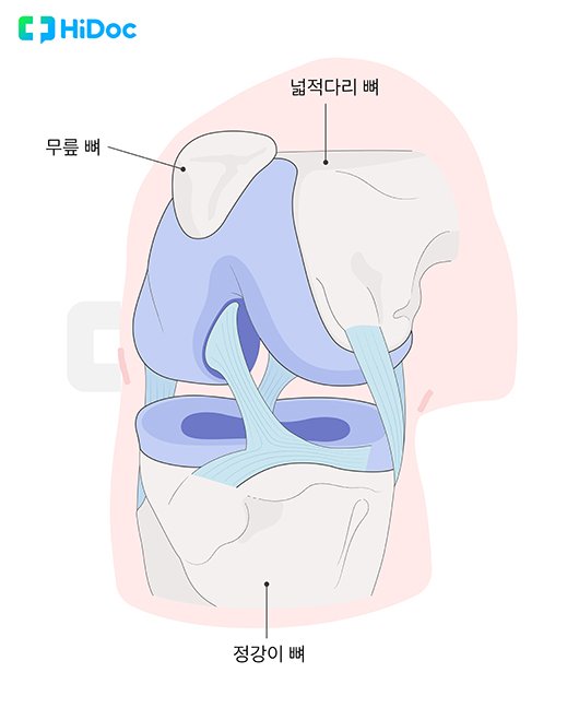 전방 십자인대ㅣ출처: 하이닥