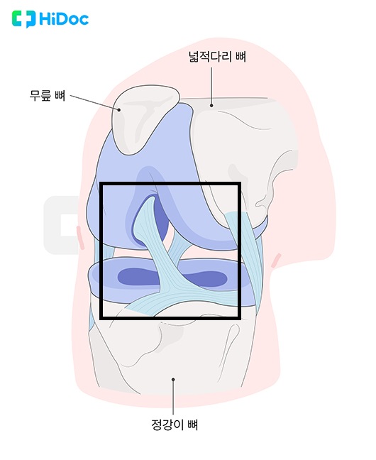 전방십자인대 ㅣ출처: 하이닥