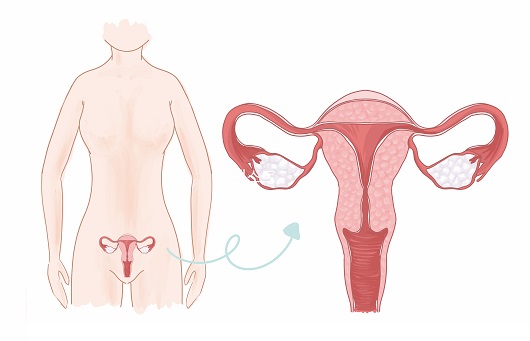 자궁근종과 난소낭종 치료, 성인여성이라면 신중한 선택 필요