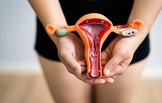 자궁근종은 가임 여성 10명 중 3~4명에서 발견될 정도로 매우 흔한 자궁 혹이다