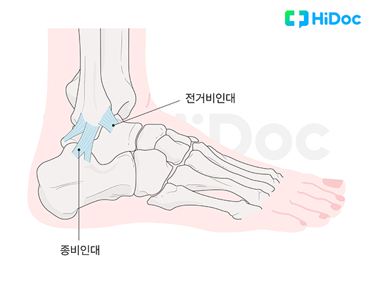 발목 외측 인대ㅣ출처: 하이닥