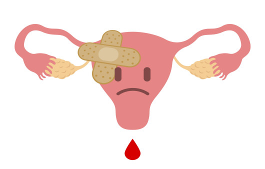 무월경이 오래 지속되면 자궁내막증식증을 유발할 수 있다ㅣ출처: 게티이미지 뱅크