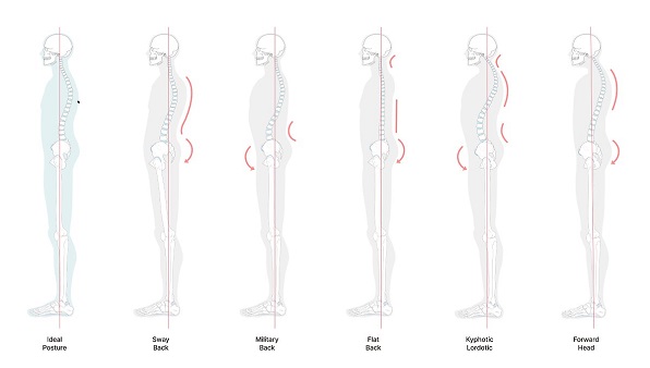 허리뼈의 C자 곡선이 무너지면 허리에 문제가 생긴다ㅣ출처: 하이닥