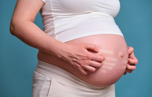 출산 후 지속되는 유두·항문 가려움, 임신소양증이 안 낫는 걸까?...가려움증 관리법 4