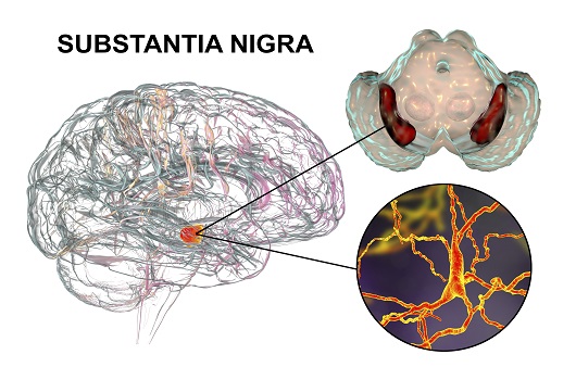 파킨슨병은 뇌의 흑색질(substantia nigra)의 도파민 신경이 퇴화되는 질병이다ㅣ출처: 게티이미지 뱅크