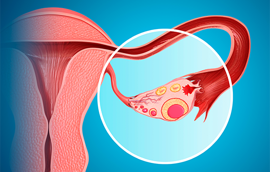 난소｜출처: 게티이미지 뱅크