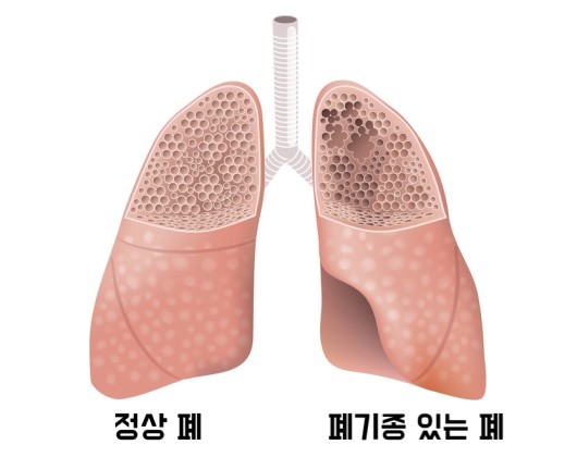 출처: 게티이미지 뱅크