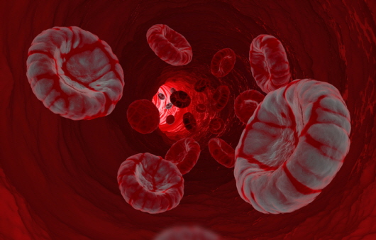 만성골수성백혈병은 골수의 정상 혈액세포가 암세포로 전환되어 증식되면서 나타난다ㅣ출처: 게티 이미지뱅크
