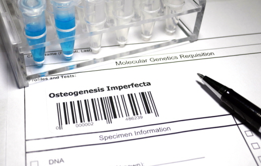 난치성 유전 질환인 ‘골형성부전증’ㅣ출처: 게티 이미지뱅크